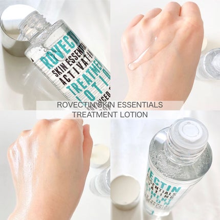 エッセンシャル トリートメントローション/ロベクチン/化粧水を使ったクチコミ(4枚目)