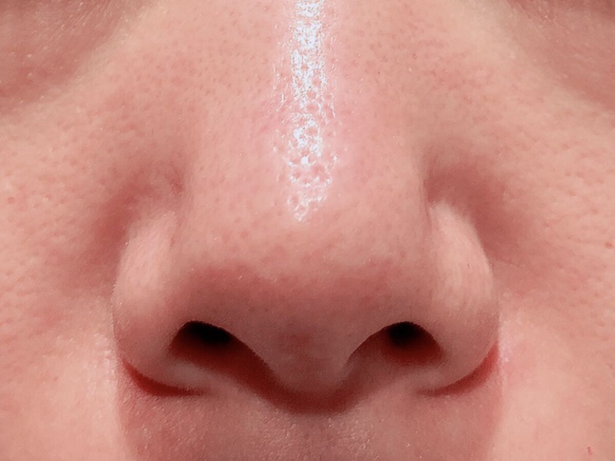 5種のセラミド配合化粧水/Aoyama・Labo/化粧水を使ったクチコミ（3枚目）