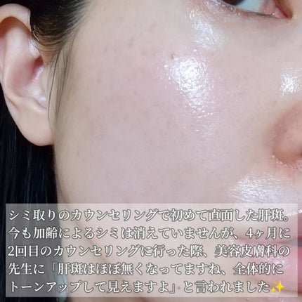 ハイドロクリームPHQ-5/KISO/フェイスクリームを使ったクチコミ(8枚目)