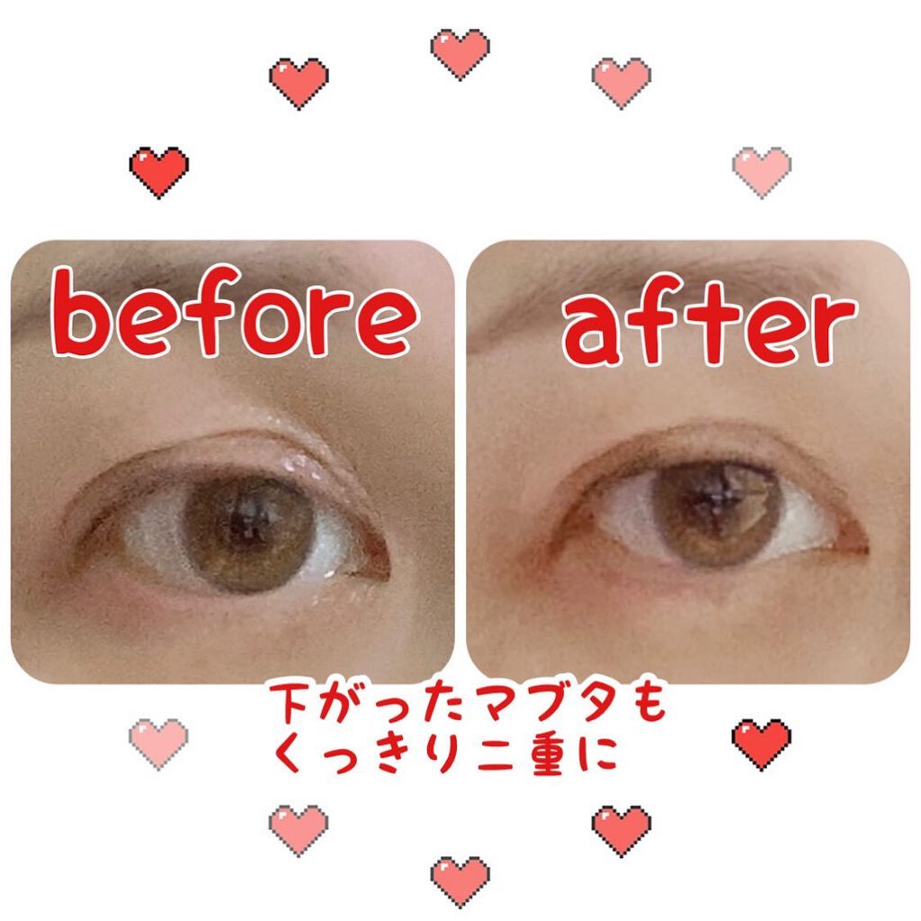 TWOOL ダブルアイリッドグルー/SHOBIDO/二重まぶた用アイテムを使ったクチコミ（3枚目）