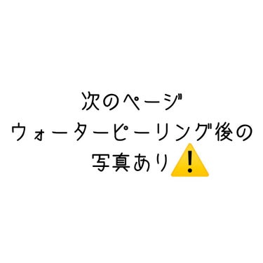 美ルル アクアルファ/belulu/美顔器・マッサージを使ったクチコミ（2枚目）