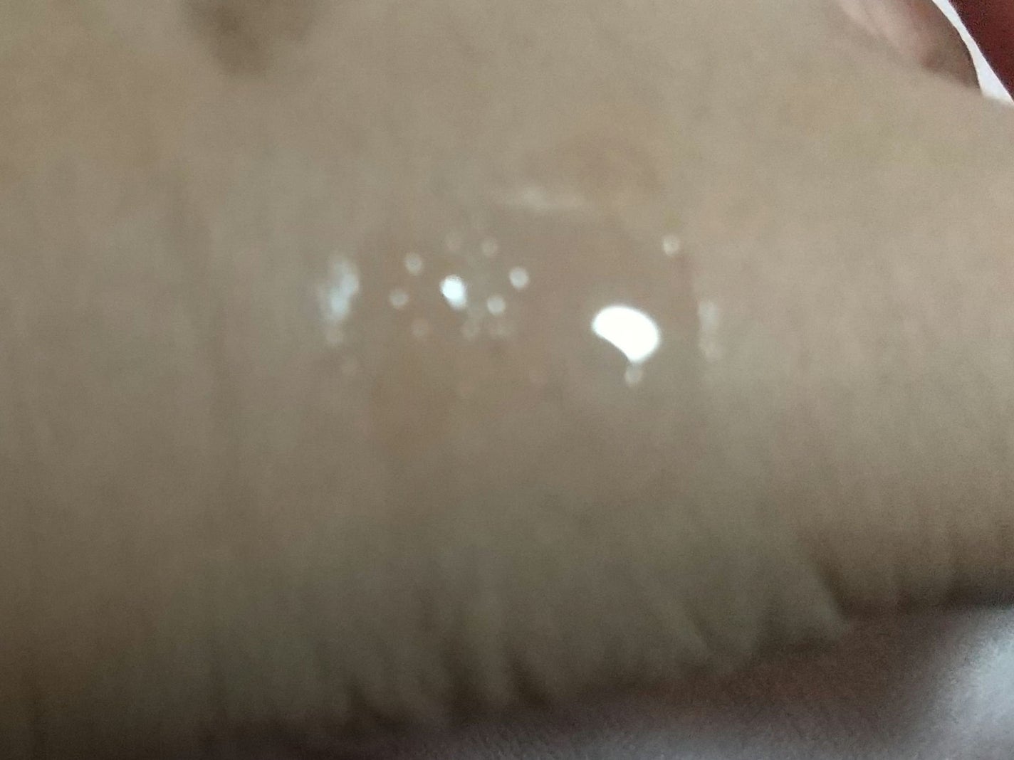 マッドピーチウォータートックスリッププランパー/MAD PEACH/リッププランパーを使ったクチコミ(6枚目)