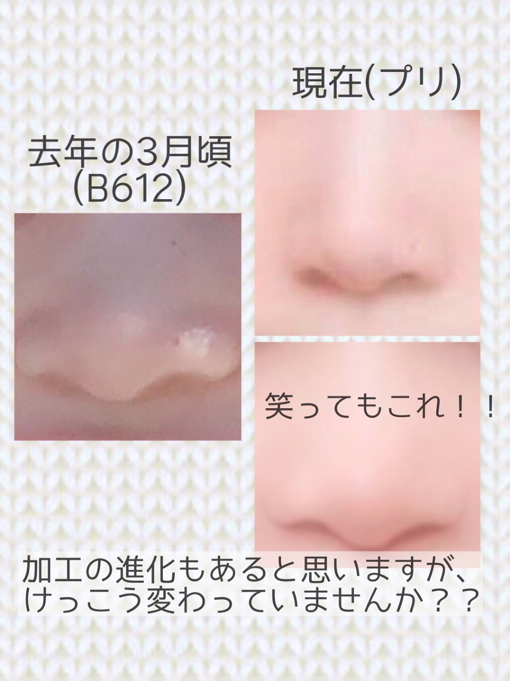 ハトムギ保湿ジェル(ナチュリエ スキンコンディショニングジェル)/ナチュリエ/美容液を使ったクチコミ（2枚目）