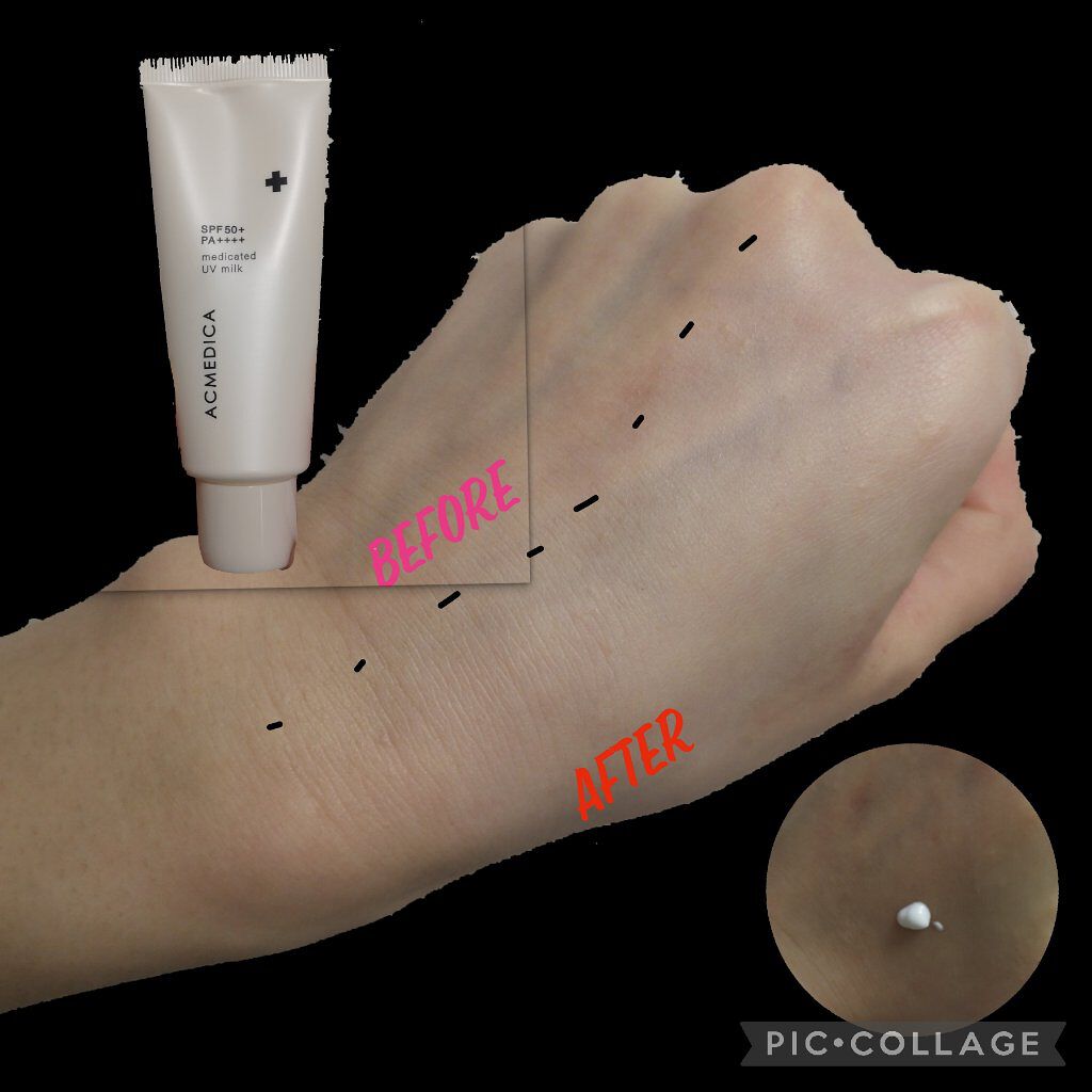 アクメディカ 薬用 UVミルク/ナリスアップ/日焼け止めミルクを使ったクチコミ(2枚目)
