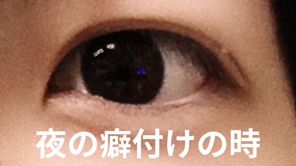 ワンダーアイリッドテープ Extra/D-UP/二重まぶた用アイテムを使ったクチコミ（2枚目）