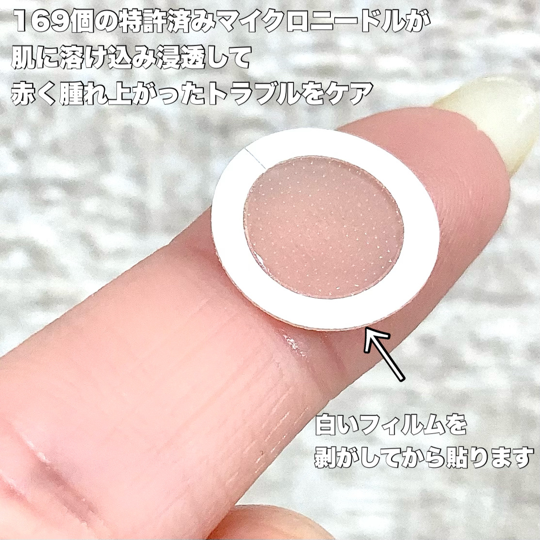 エーキュアショットスポットパッチ/obsero/にきびパッチを使ったクチコミ（3枚目）