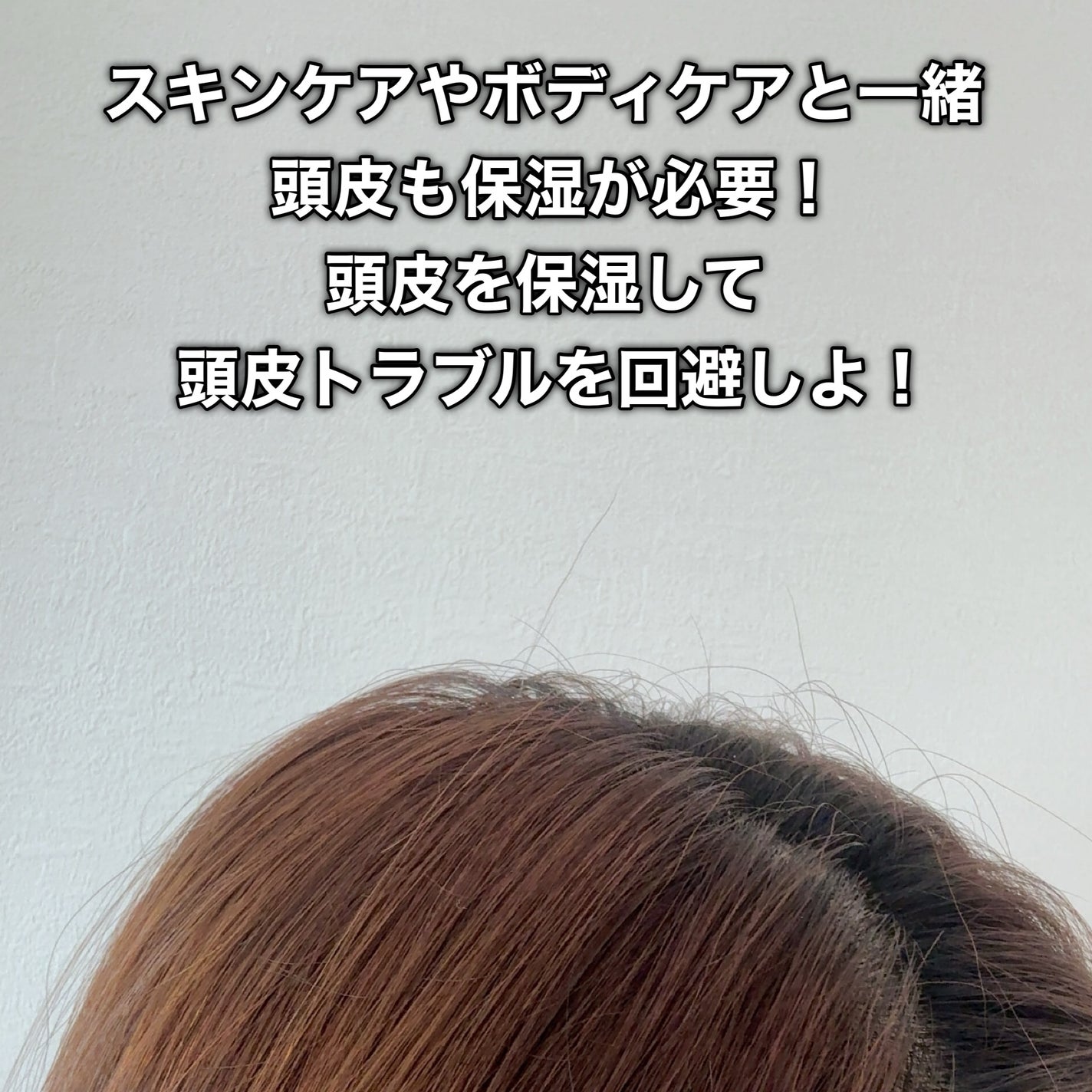 スカルプオイルローション/ATPLON/頭皮ローションを使ったクチコミ(8枚目)