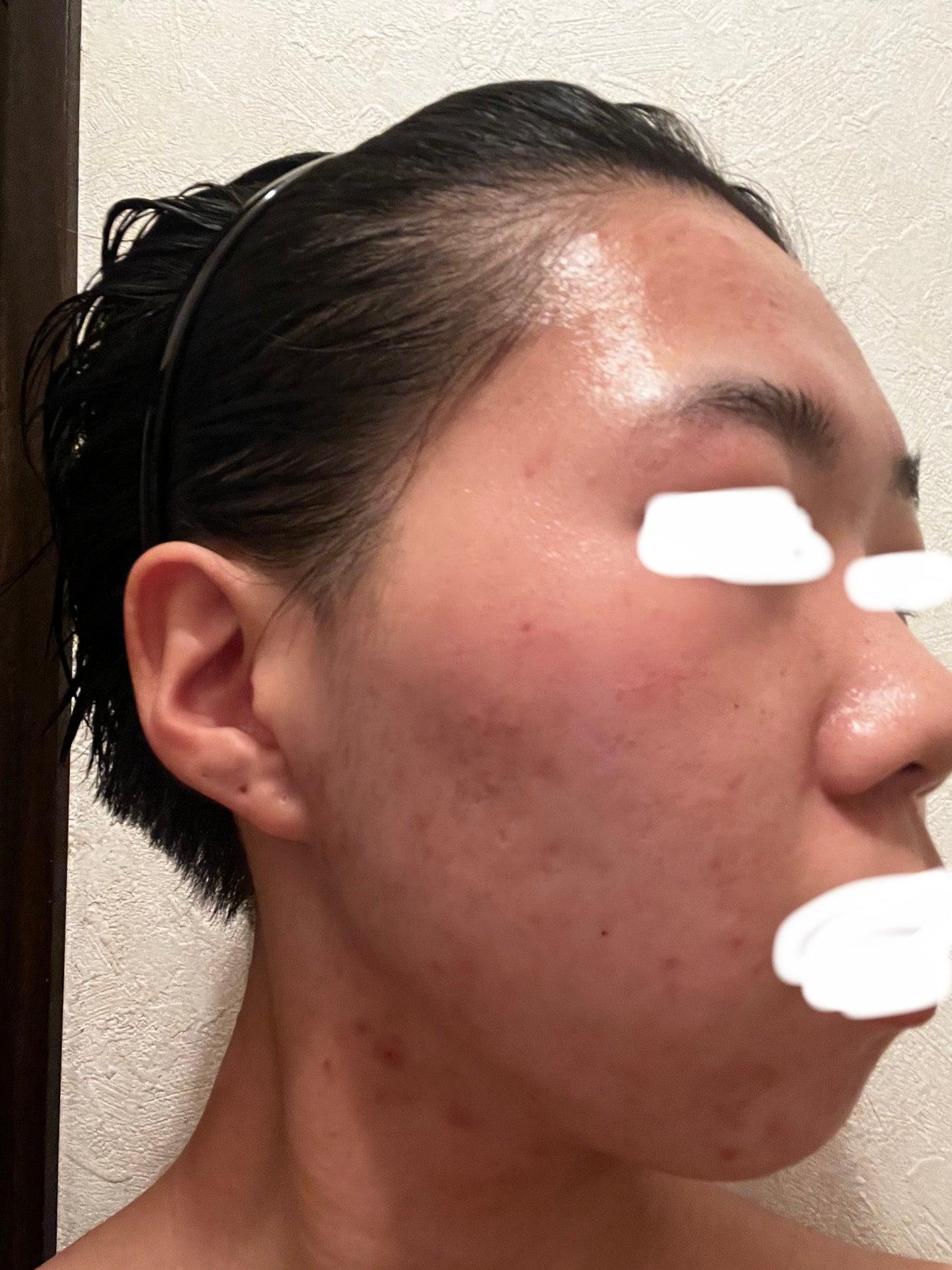 RXザ・レチノール0.1クリーム/COSRX/フェイスクリームを使ったクチコミ(2枚目)