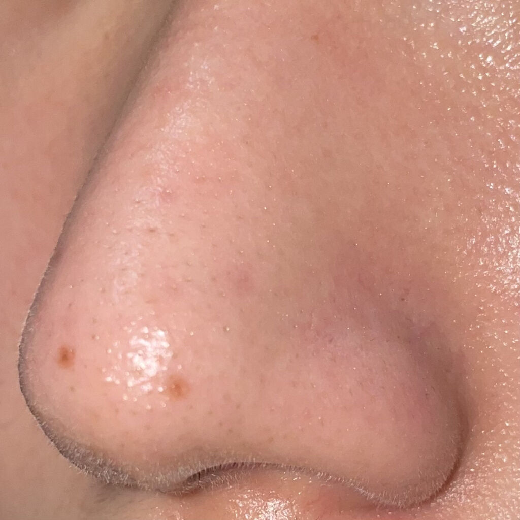 ノーモアブラックヘッド(ノーズピーリング)/One-day's you/スクラブ・ゴマージュを使ったクチコミ（2枚目）