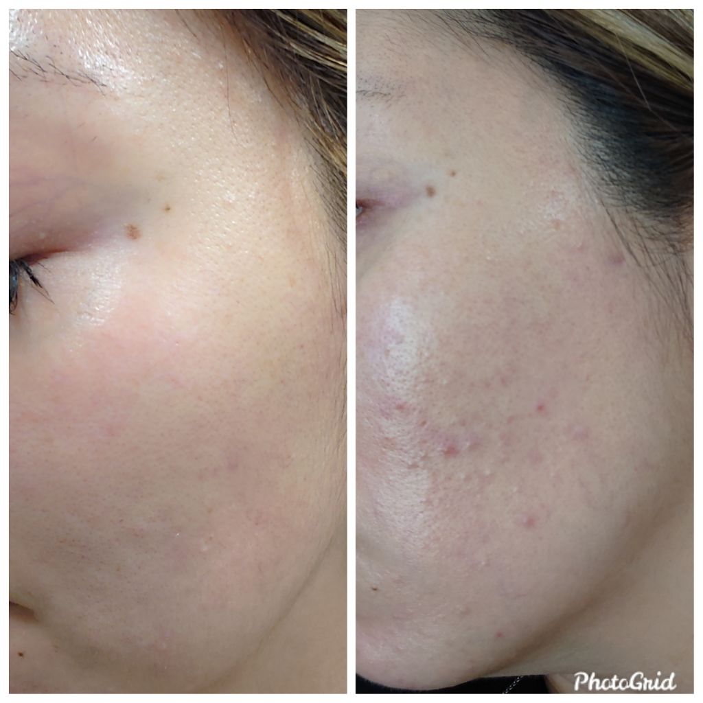 薬用ホワイトレディ/HABA/美容液を使ったクチコミ(1枚目)