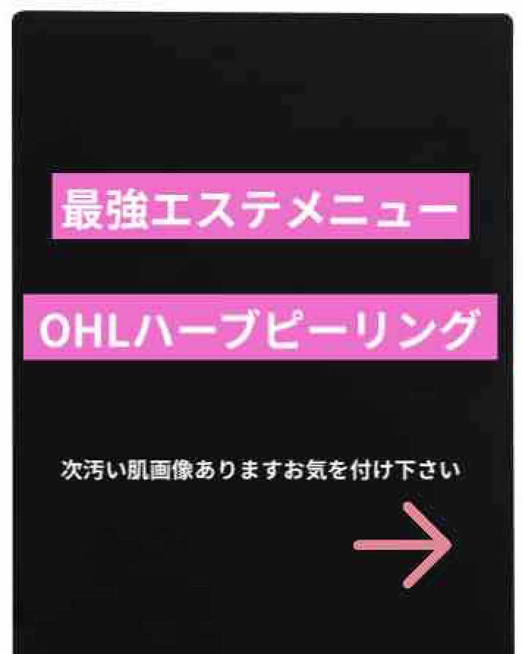 プロポリス エネルギーアンプル/CNP Laboratory/美容液を使ったクチコミ（1枚目）