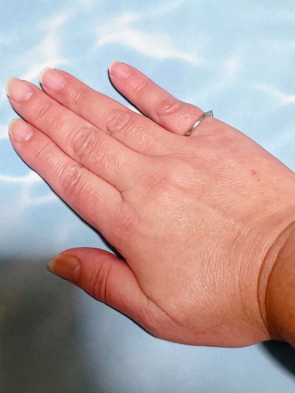 9番 NMNバイオリフト濃縮美容液/numbuzin/美容液を使ったクチコミ(5枚目)