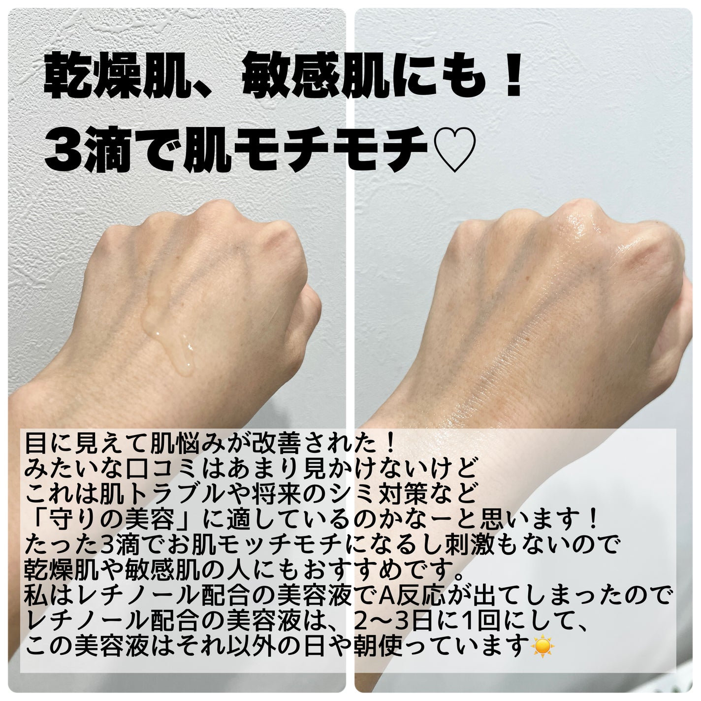 5番 白玉グルタチオンC美容液/numbuzin/美容液を使ったクチコミ(3枚目)