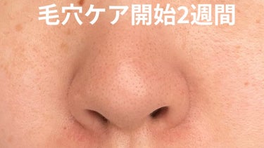 化粧水　敏感肌用　さっぱりタイプ/無印良品/化粧水を使ったクチコミ（2枚目）