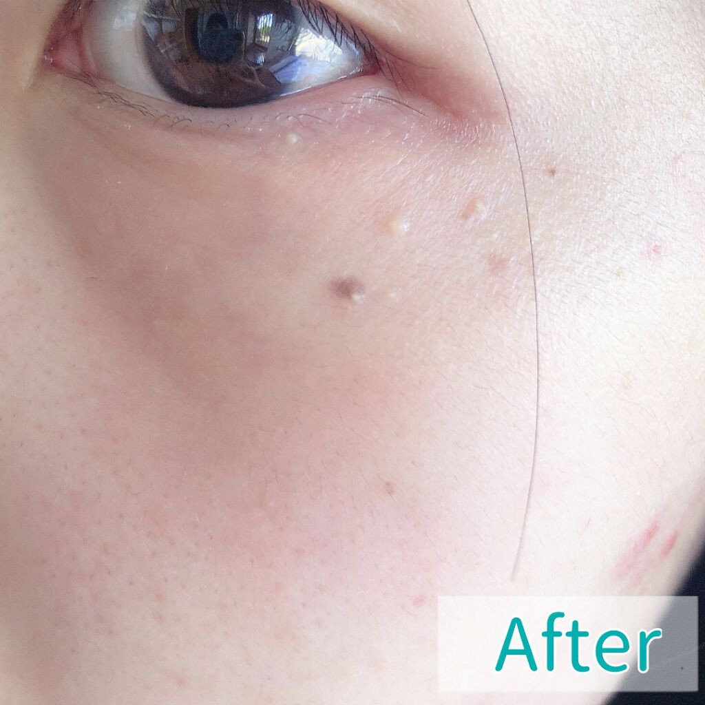 ホホバオイル/無印良品/ボディオイルを使ったクチコミ(7枚目)