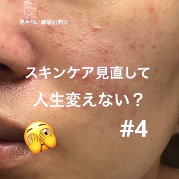 ビタペアC 集中美容液スペシャルセット/ネイチャーリパブリック/美容液を使ったクチコミ(1枚目)