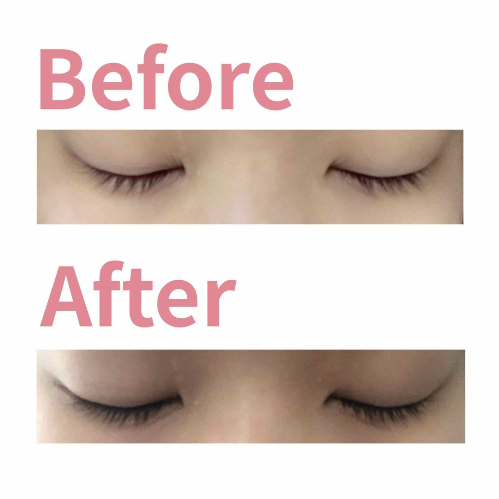 ローヤルゼリー配合 栄養ローション/DAISO/美容液を使ったクチコミ（1枚目）