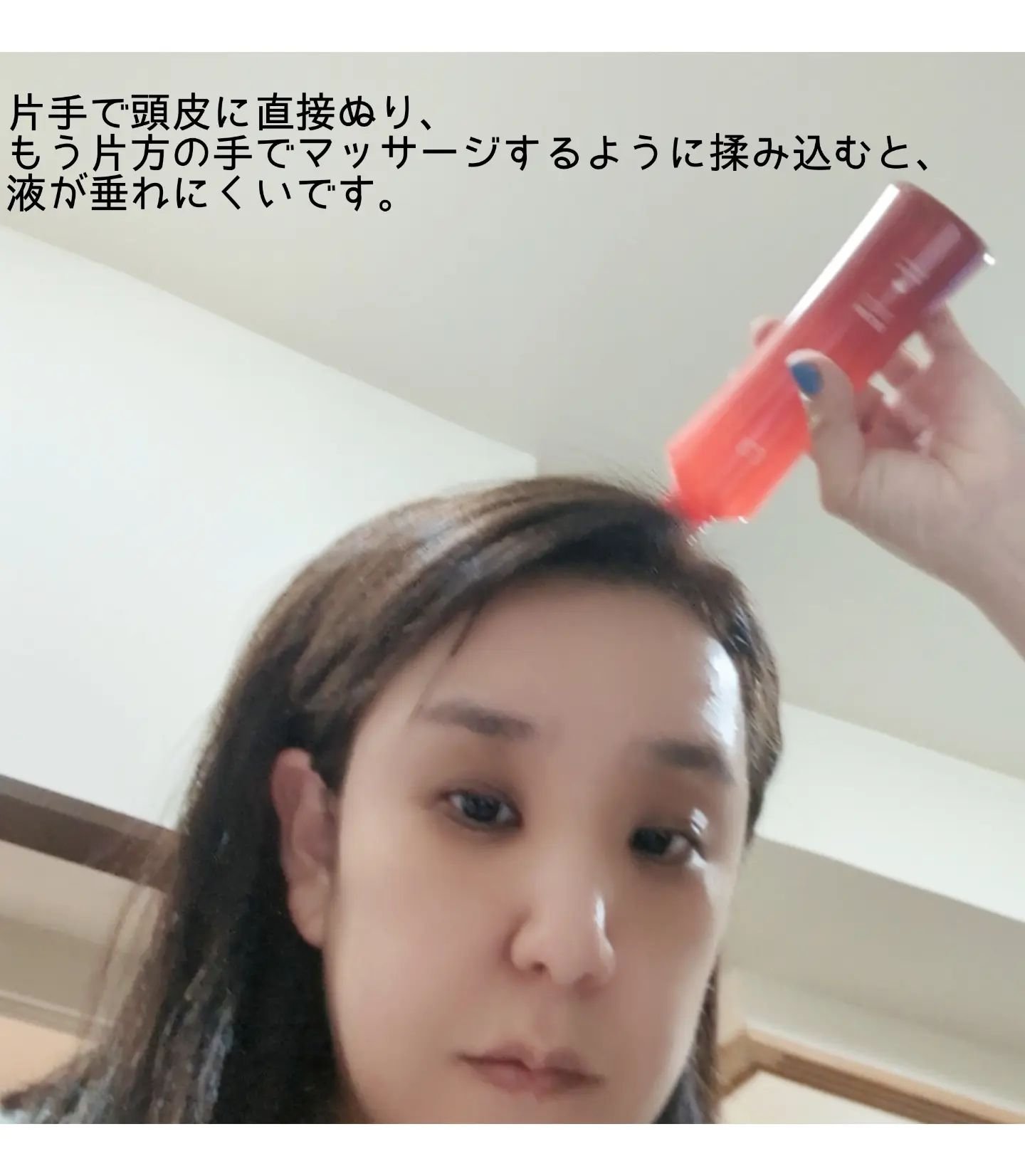 薬用 RJ地肌ケア エッセンス /アピセラピーコスメティクス/頭皮ローションを使ったクチコミ（3枚目）