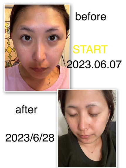 shirocara薬用ホワイトニングジェル/shirocara/オールインワン化粧品を使ったクチコミ(4枚目)