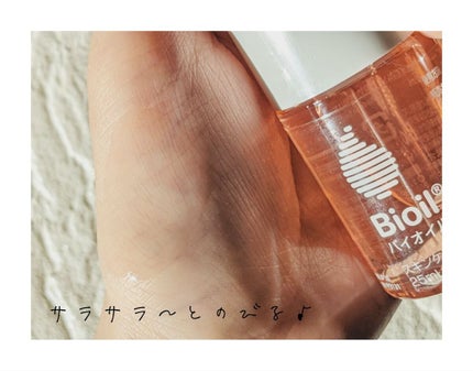 バイオイル/バイオイル/フェイスオイルを使ったクチコミ(3枚目)