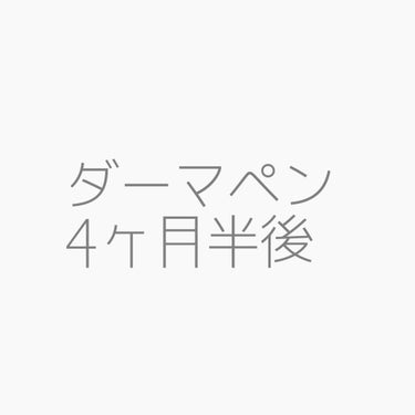 ダーマペン　4ヶ月半　経過
お久しぶりです✌️

地道にダーマペンを続けて4ヶ月半が経ちました

以前までは、毎週毎週ダーマペンを行っていましたが、DTを考えて今は3週間に1回のペースに変えました！
セ