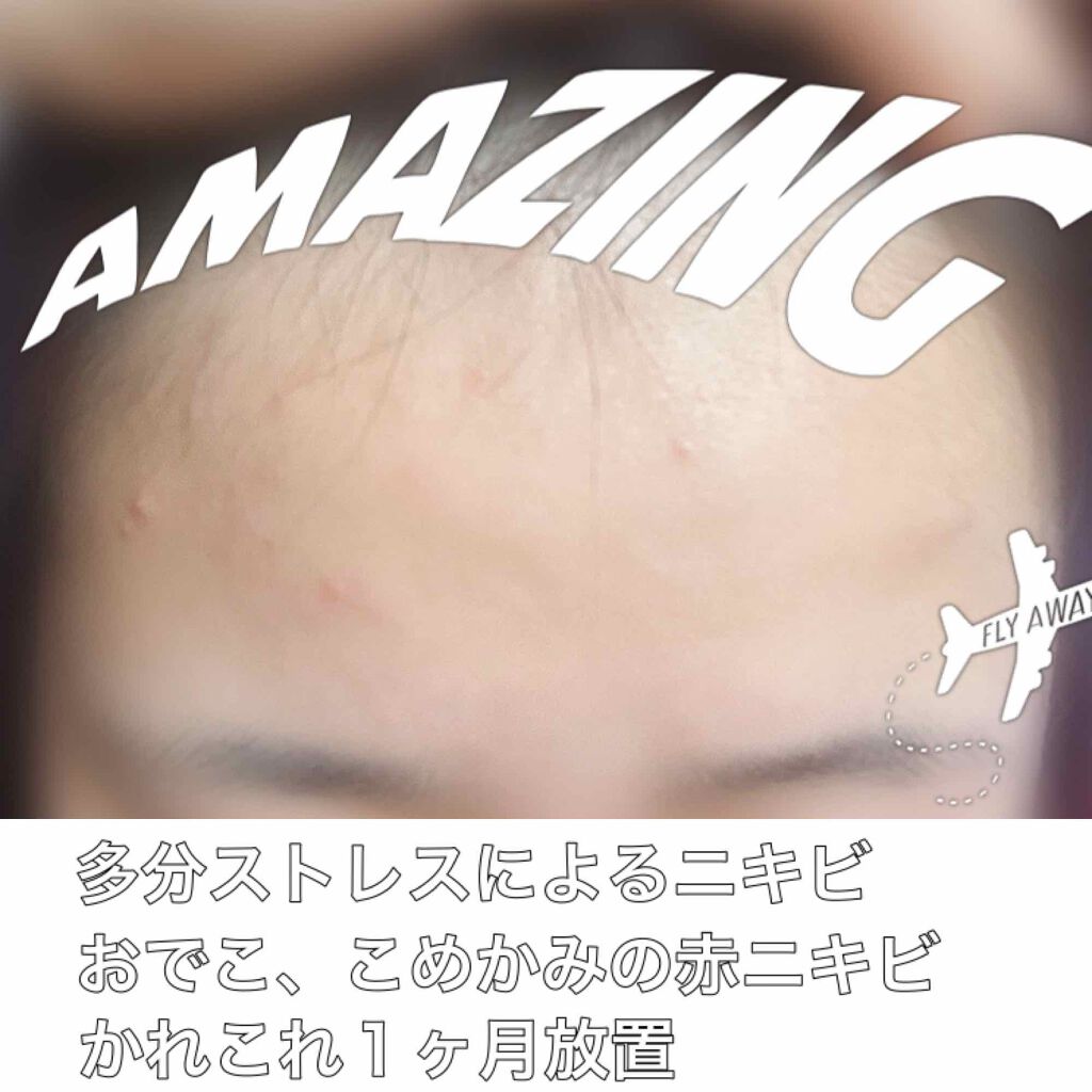 DHC ビタミンＣハードカプセル/DHC/美容サプリメントを使ったクチコミ（2枚目）