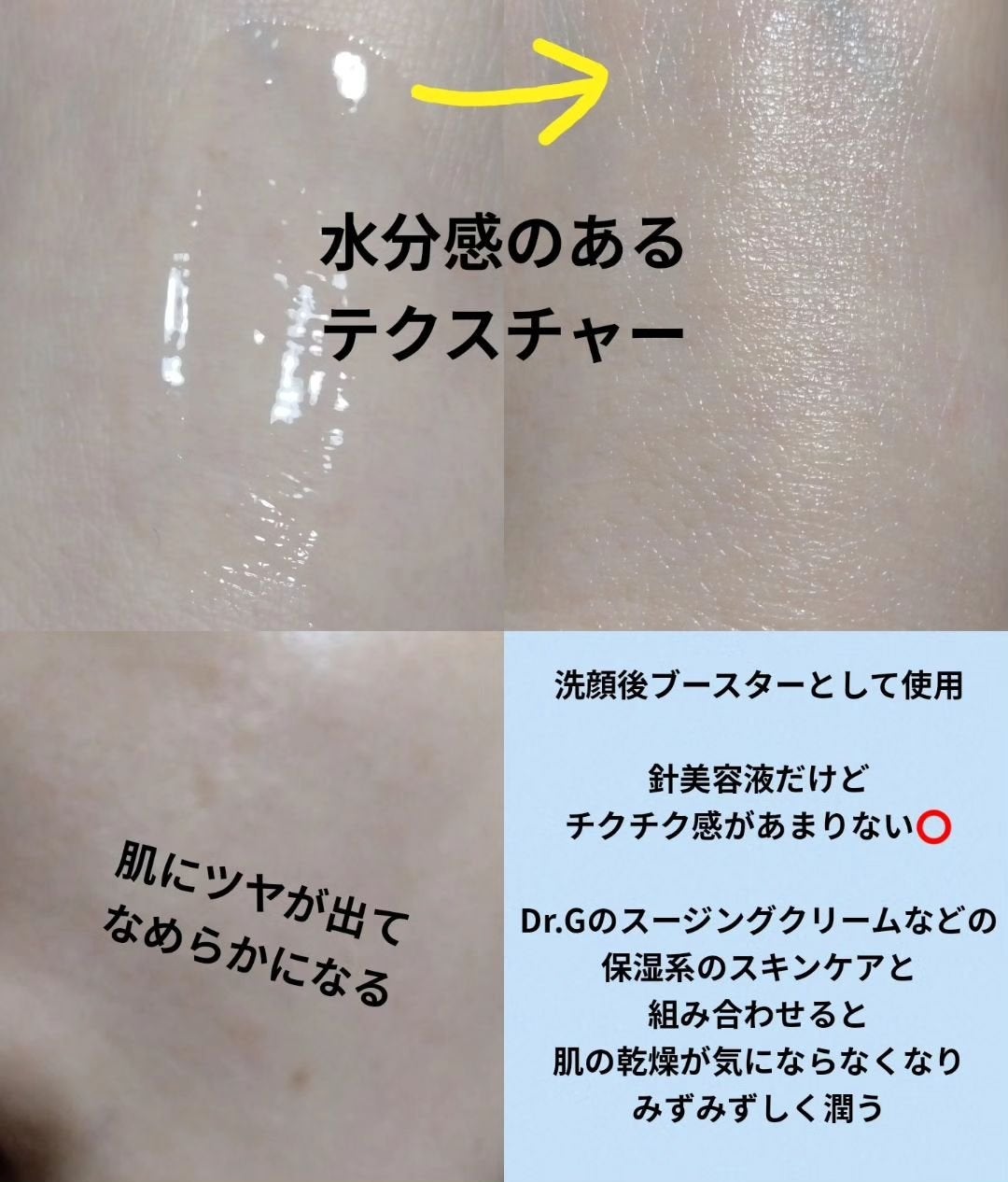 RTXセラム ヒアルショット/Dr.G/美容液を使ったクチコミ(3枚目)