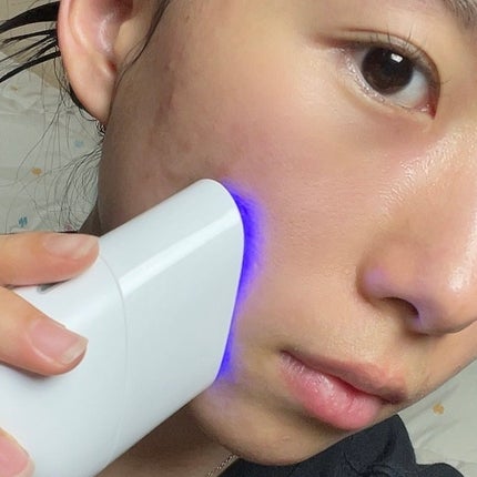 スキンライトセラピーII/Makeon/美顔器・マッサージを使ったクチコミ(4枚目)