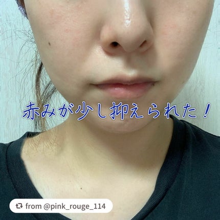 マイリアル スクイーズ マスクシート/innisfree/シートマスク・パックを使ったクチコミ(3枚目)