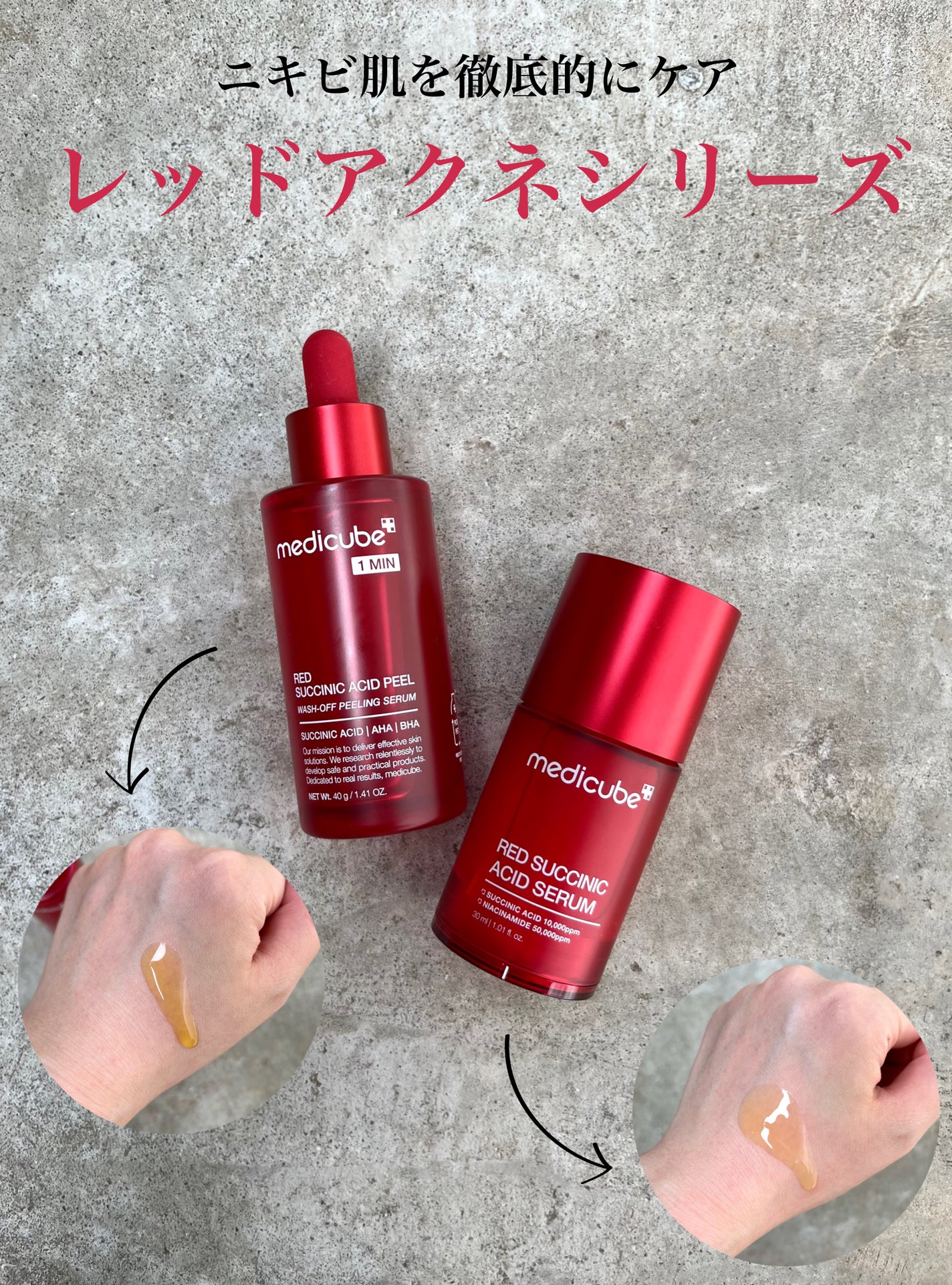 tomomi|コスメレビュー on LIPS 「ニキビ肌を撃退👊🏻ピーリング&鎮静ケアの2ステップで徹底的にケ..」(1枚目)