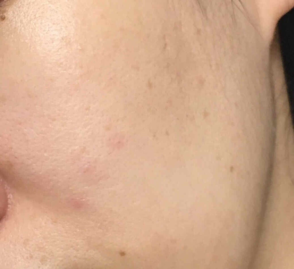 タカミスキンピール/タカミ/ブースター・導入液を使ったクチコミ(3枚目)