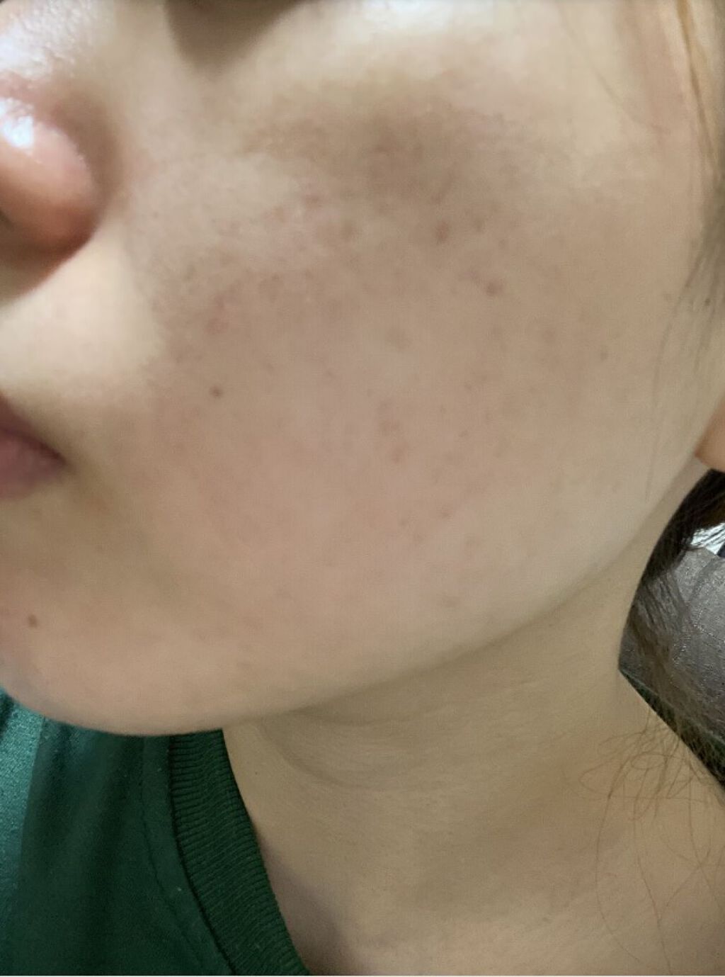 ホワイトニング クリアチャージ ウォーター/アルージェ/ミスト状化粧水を使ったクチコミ（3枚目）