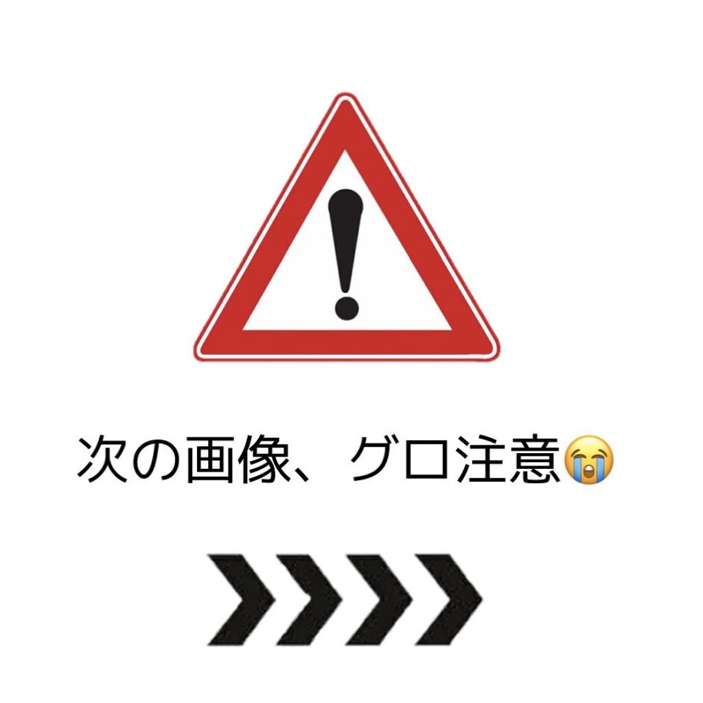 チョコラBBドリンクビット（医薬品）/チョコラBB/その他を使ったクチコミ（2枚目）