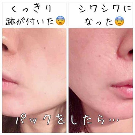 新タック化成 保湿ケアパックシートA/新タック化成/シートマスク・パックを使ったクチコミ(4枚目)