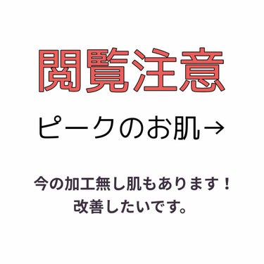 のり弁🍱 on LIPS 「ピーク頃と今の肌です！今は肌の赤みとクレーターに悩んでます…い..」（1枚目）