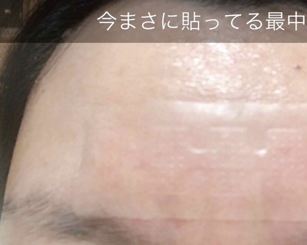 オデコディープパッチ/北の快適工房/シートマスク・パックを使ったクチコミ（3枚目）