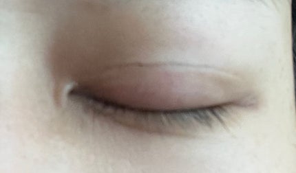 TWOOL ダブルアイリッドグルー/SHOBIDO/二重まぶた用アイテムを使ったクチコミ(5枚目)