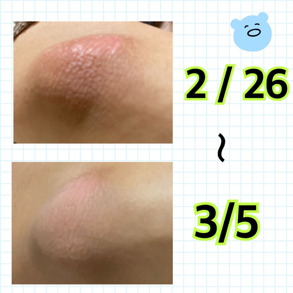 ビューティーチャージ ピーチティーの香り/アトリックス/ハンドクリームを使ったクチコミ(2枚目)