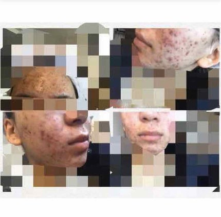 ドルマイシン軟膏(医薬品)/ゼリア新薬工業/その他を使ったクチコミ(3枚目)