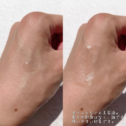 モイスチュアマイルドホワイトリペアエッセンス C100/モイスチュアマイルド ホワイト/美容液を使ったクチコミ(3枚目)