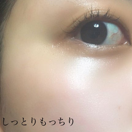 インテンシブリペアリングトラベルセット/エィセーフ/スキンケアキットを使ったクチコミ(8枚目)