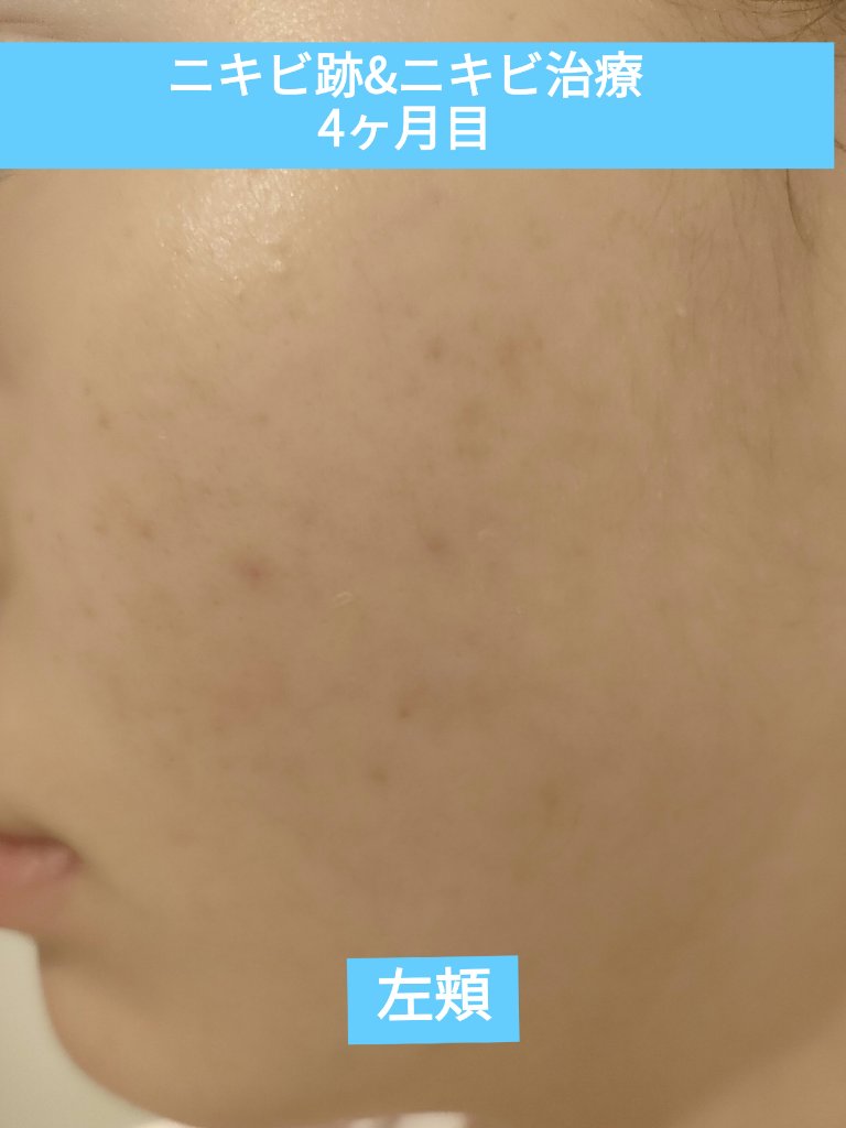 UVシールドEX/NOV/日焼け止めクリームを使ったクチコミ（1枚目）