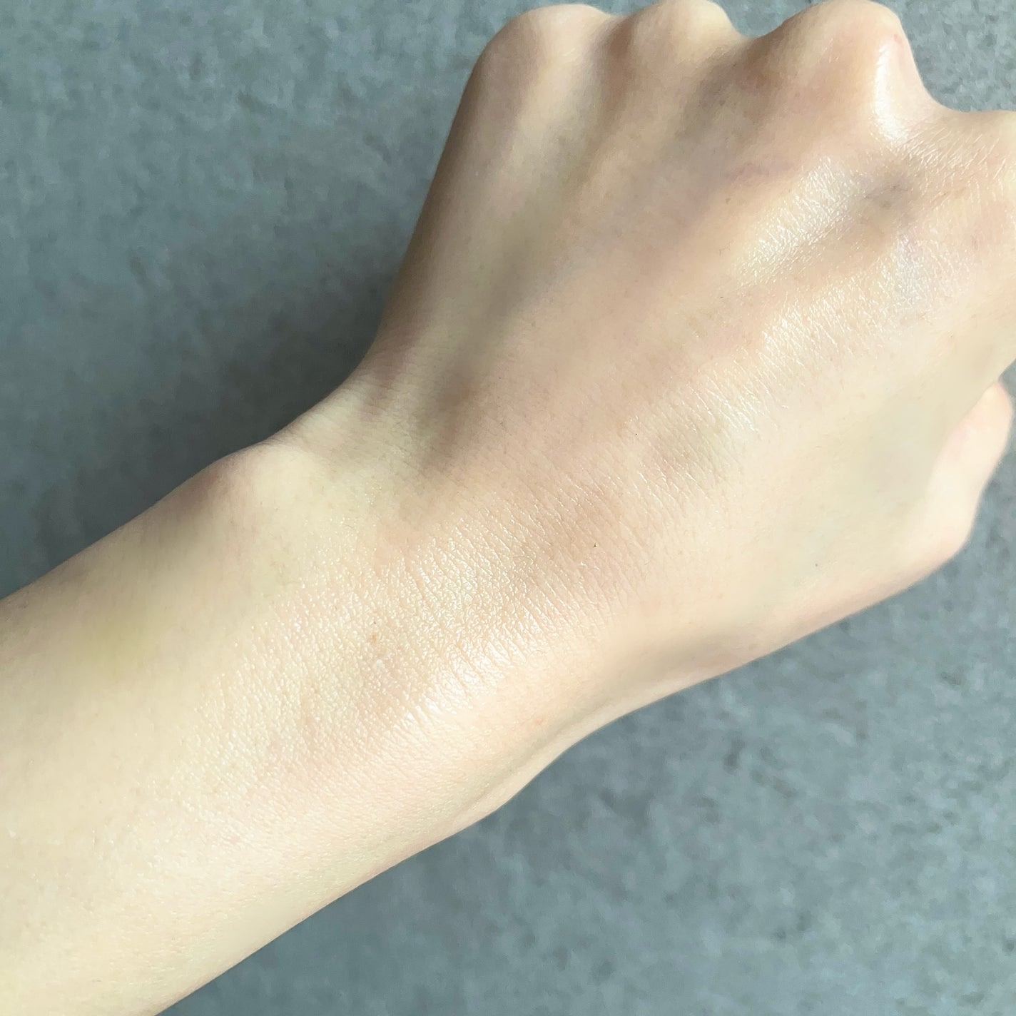 オードムーゲ 薬用ローション(ふきとり化粧水)/オードムーゲ/拭き取り化粧水を使ったクチコミ(4枚目)