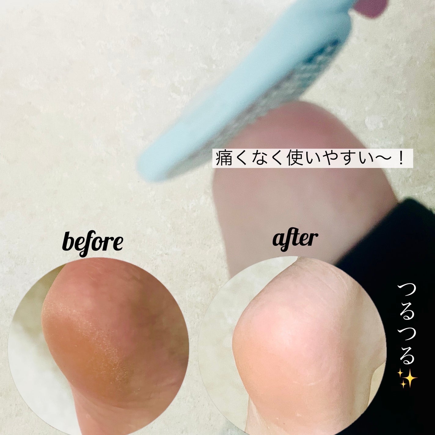 角質削り/グリーンベル/レッグ・フットケアを使ったクチコミ(3枚目)