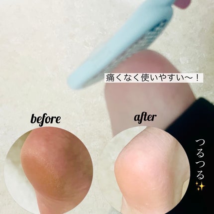 角質削り/グリーンベル/レッグ・フットケアを使ったクチコミ(3枚目)