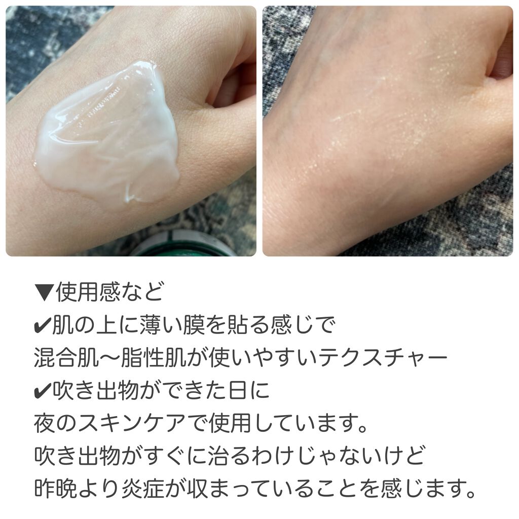AHA·BHA·PHA 30デイズミラクルクリーム/SOME BY MI/フェイスクリームを使ったクチコミ(3枚目)