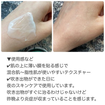 AHA·BHA·PHA 30デイズミラクルクリーム/SOME BY MI/フェイスクリームを使ったクチコミ(3枚目)