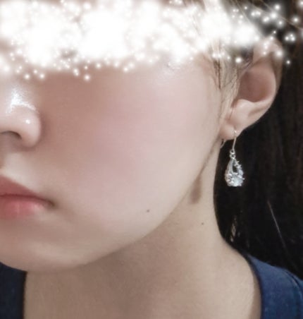 DETクリア ブライト&ピール ピーリングジェリー<無香料タイプ>/Detclear/ピーリングを使ったクチコミ(1枚目)