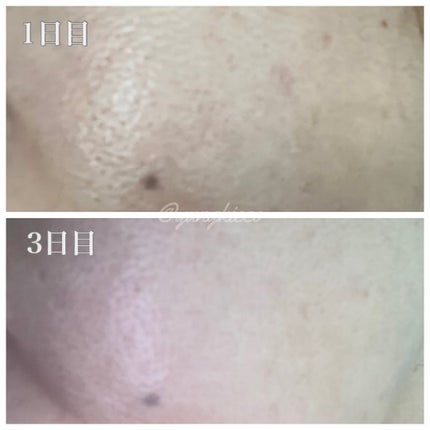 リードルS 100 2ステップマスク/VT/シートマスク・パックを使ったクチコミ(5枚目)