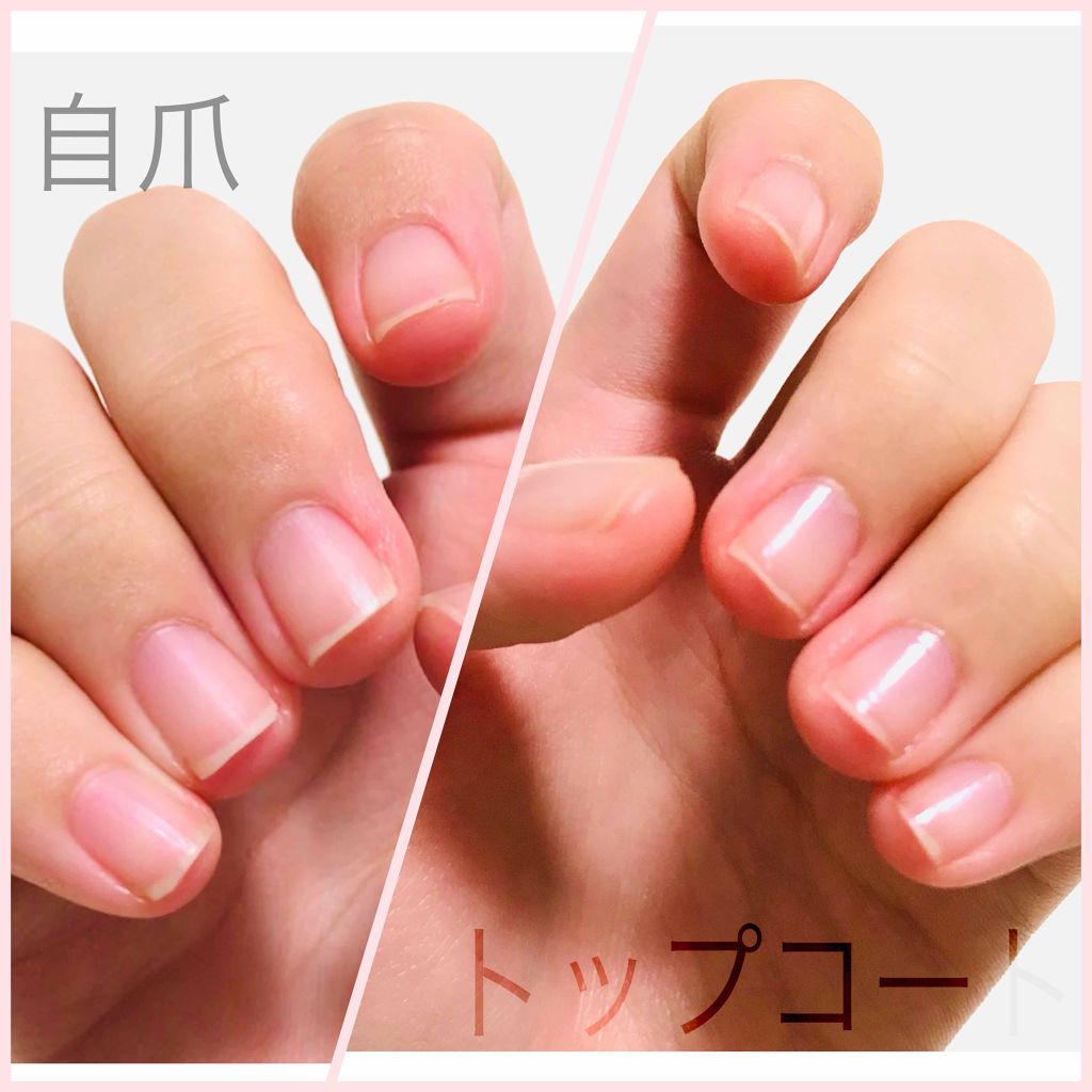 トップコート/KATE/ネイルトップコートを使ったクチコミ(2枚目)